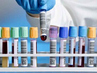 پلیمرها و صنعت پزشکی - پلاستوایران